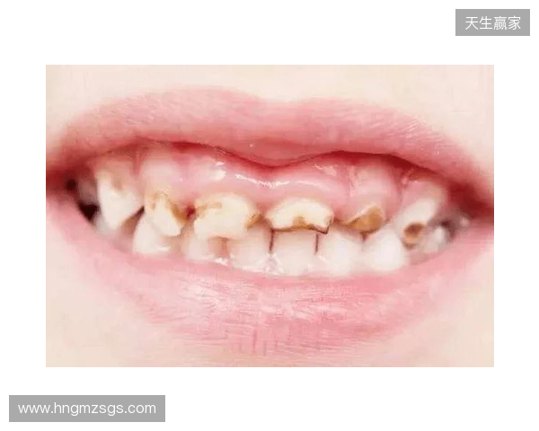 韦林顿确诊上唇部贯通伤；11、21牙半脱位；上颌前牙区牙槽骨骨折